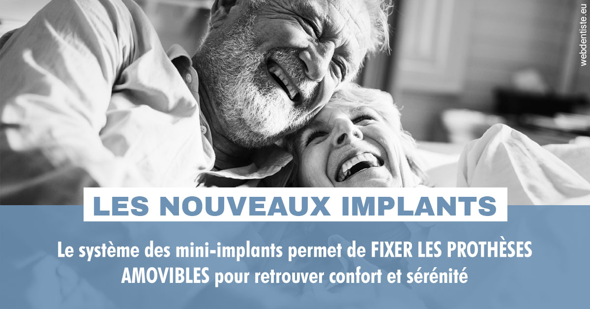 https://www.cabinetdocteursrispalmoussus.fr/Les nouveaux implants 2