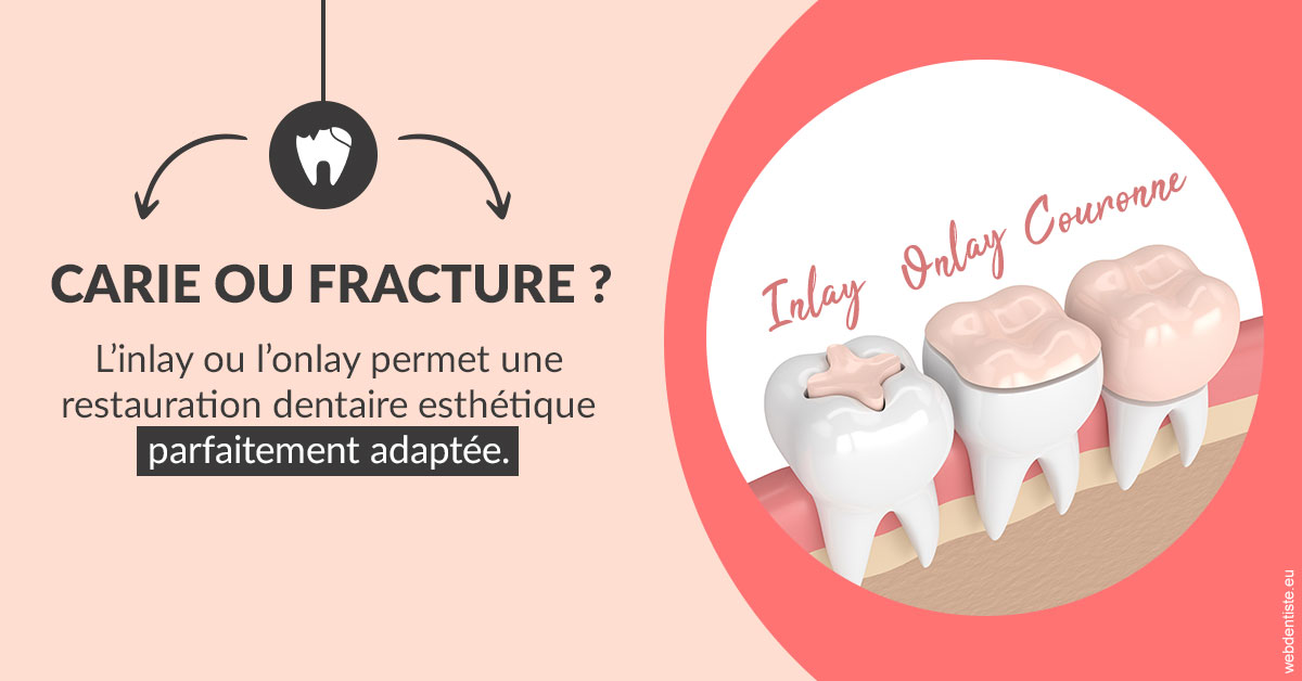 https://www.cabinetdocteursrispalmoussus.fr/T2 2023 - Carie ou fracture 2