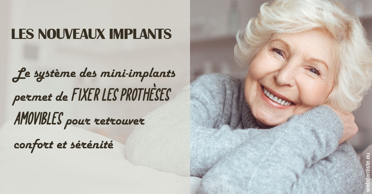 https://www.cabinetdocteursrispalmoussus.fr/Les nouveaux implants 1
