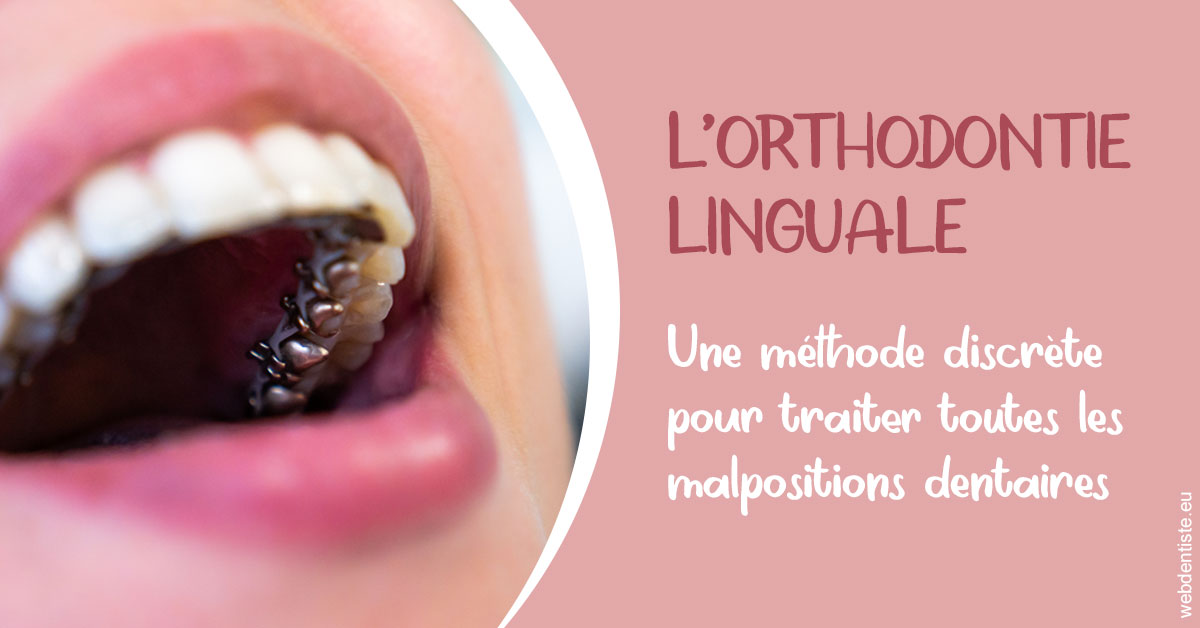 https://www.cabinetdocteursrispalmoussus.fr/L'orthodontie linguale 2