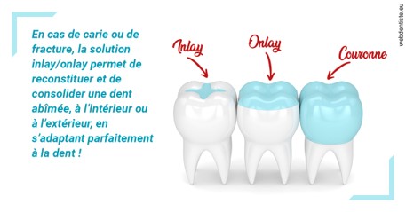 https://www.cabinetdocteursrispalmoussus.fr/L'INLAY ou l'ONLAY