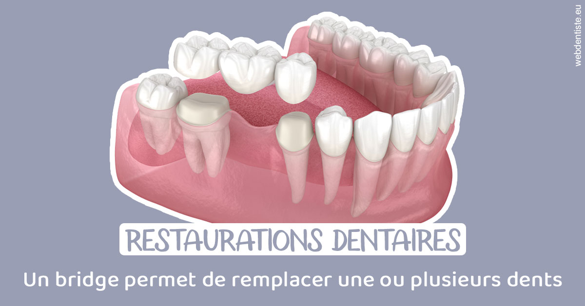 https://www.cabinetdocteursrispalmoussus.fr/Bridge remplacer dents 1