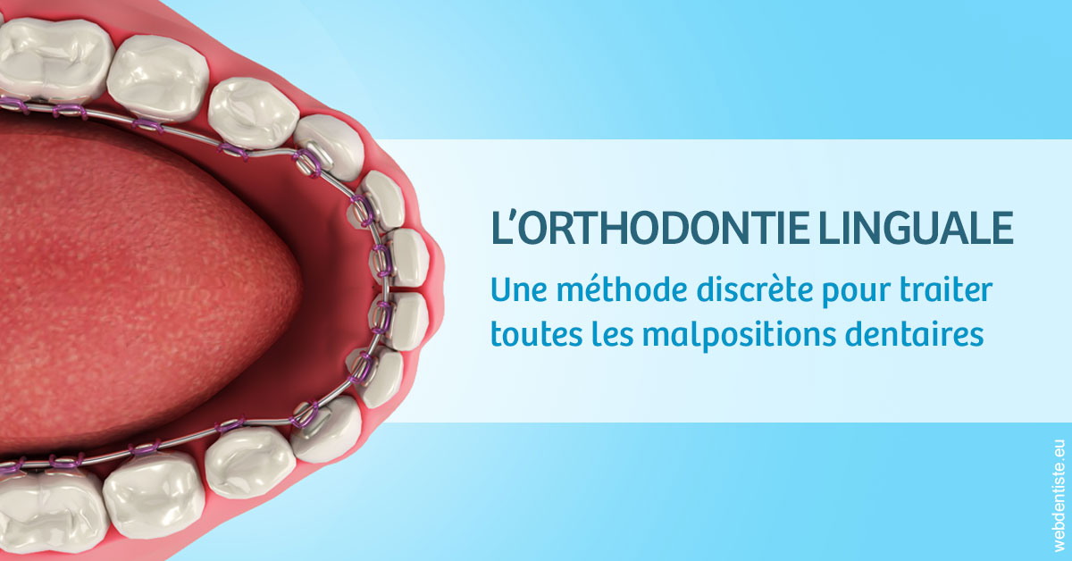 https://www.cabinetdocteursrispalmoussus.fr/L'orthodontie linguale 1