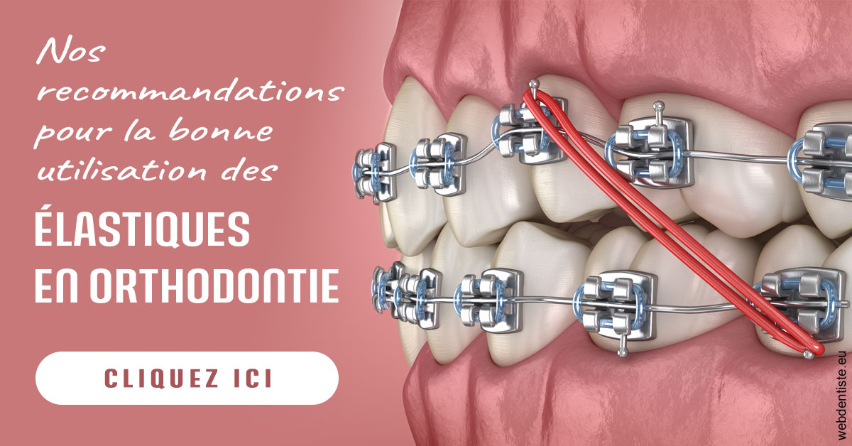 https://www.cabinetdocteursrispalmoussus.fr/Elastiques orthodontie 2